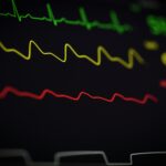 『パルス圧縮』についてLLMに聞いてみた—AIが導く研究メモ